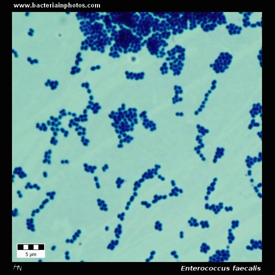 Enterococcus faecalis   
                         microscopy, gram-positive cocci